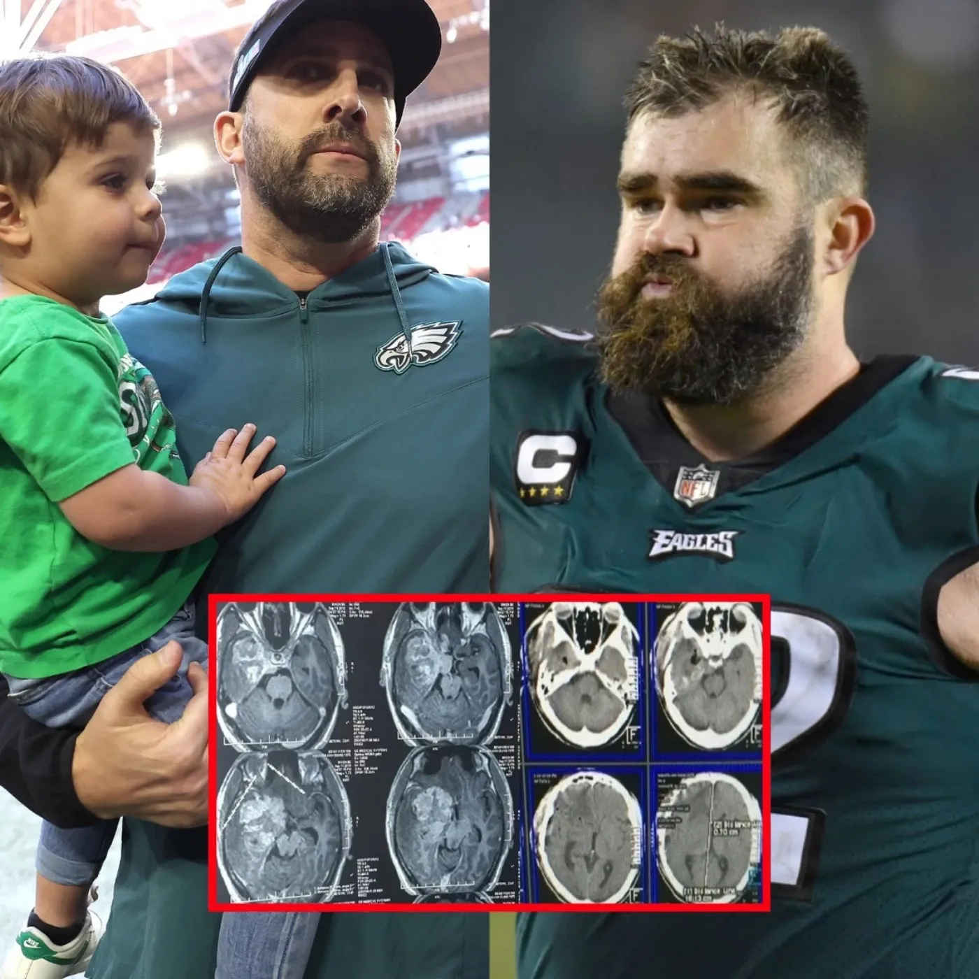 SAD NEWS: Nick Sirianni Opens Up About His Son’s Health Struggles